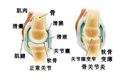 膝关节7.jpg